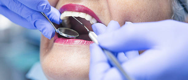 Best Emergency Gum Treatment in Clayton, NJ